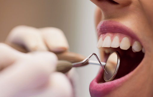 A woman receives a dental cleaning at Alfred Cheng Orthodontic Clinic using a dental tool.