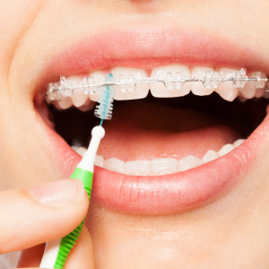 A woman brushing her teeth at Alfred Cheng Orthodontic Clinic, promoting good oral hygiene practices.